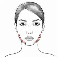 Face Treatment - Jawlines Illustration
