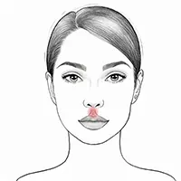 Face Treatment - Perioral Illustration